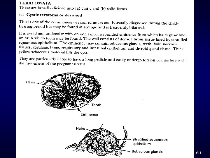 2003 -10 -27 Ovarian Cancer 60 