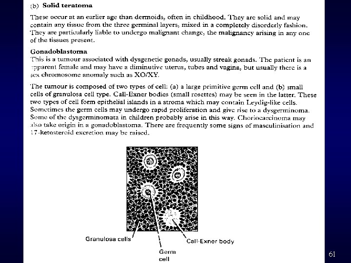 2003 -10 -27 Ovarian Cancer 61 