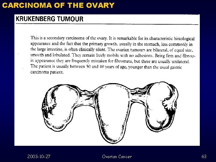 CARCINOMA OF THE OVARY 2003 -10 -27 Ovarian Cancer 63 