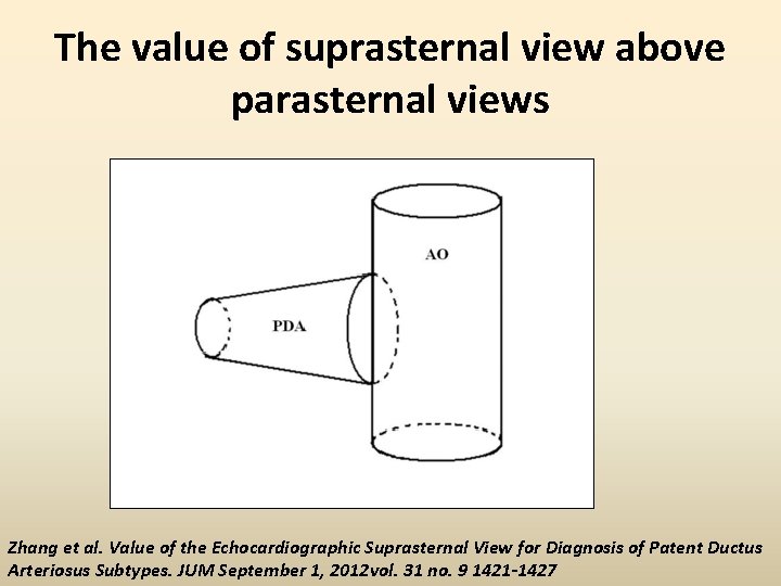 The value of suprasternal view above parasternal views Zhang et al. Value of the
