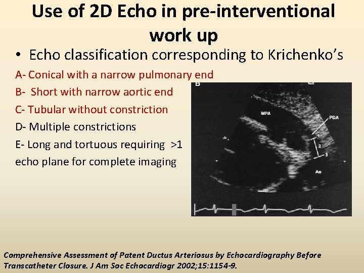 Use of 2 D Echo in pre-interventional work up • Echo classification corresponding to