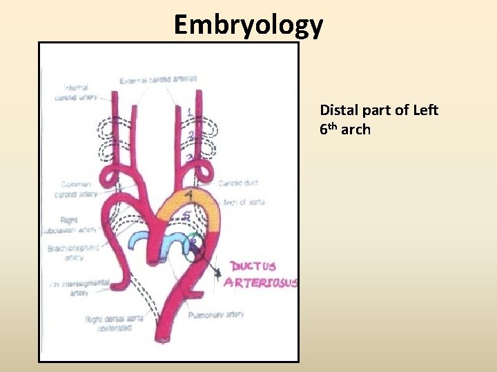 Embryology Distal part of Left 6 th arch 
