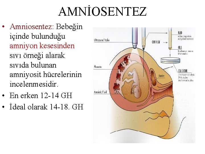 AMNİOSENTEZ • Amniosentez: Bebeğin içinde bulunduğu amniyon kesesinden sıvı örneği alarak sıvıda bulunan amniyosit