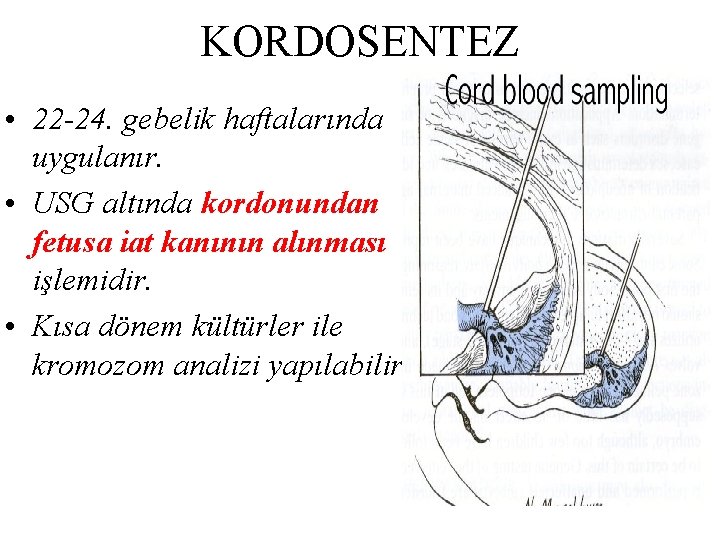 KORDOSENTEZ • 22 -24. gebelik haftalarında uygulanır. • USG altında kordonundan fetusa iat kanının