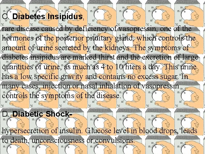 C. Diabetes Insipidus, rare disease caused by deficiency of vasopressin, one of the hormones