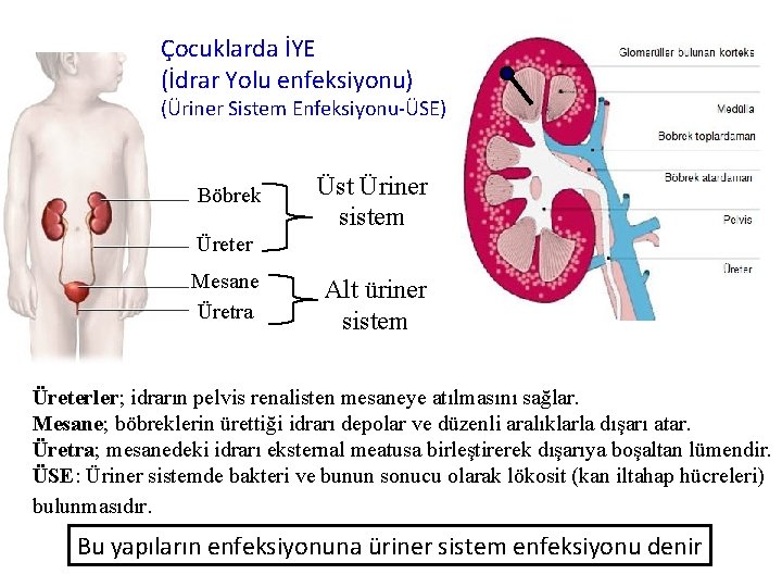 Çocuklarda İYE (İdrar Yolu enfeksiyonu) (Üriner Sistem Enfeksiyonu-ÜSE) Böbrek Üst Üriner sistem Üreter Mesane