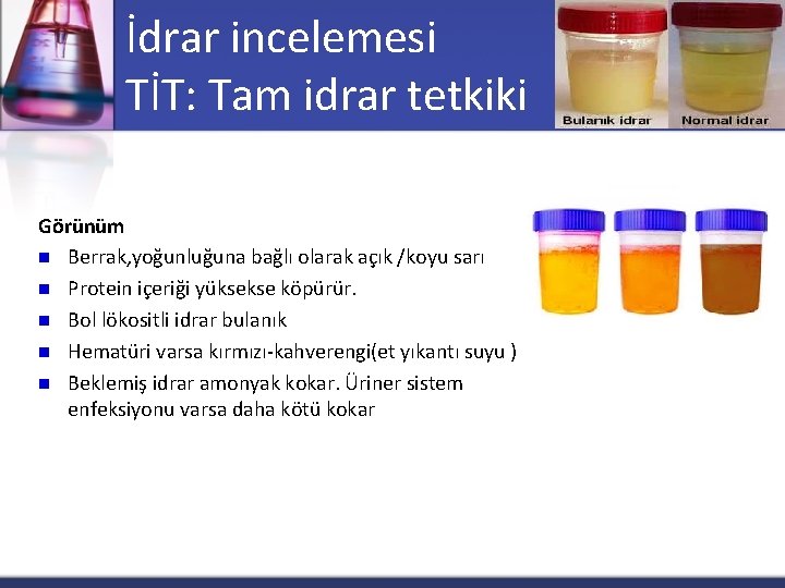 İdrar incelemesi TİT: Tam idrar tetkiki Görünüm n Berrak, yoğunluğuna bağlı olarak açık /koyu