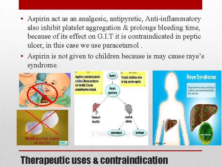  • Aspirin act as an analgesic, antipyretic, Anti-inflammatory also inhibit platelet aggregation &