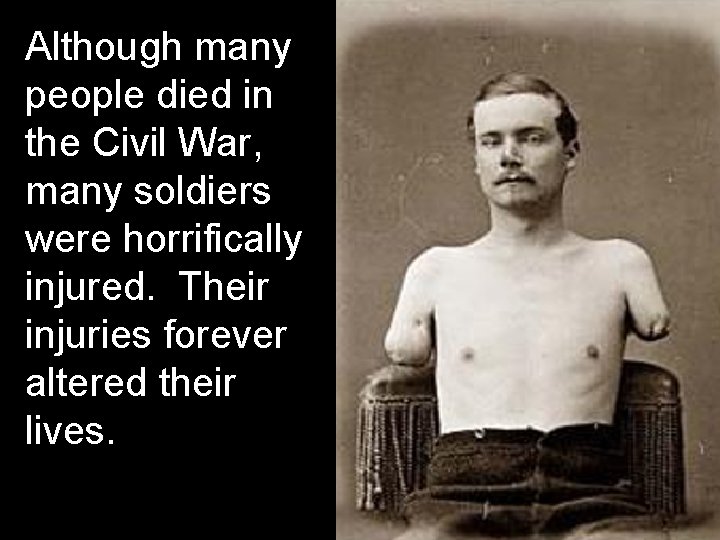 Although many people died in the Civil War, many soldiers were horrifically injured. Their