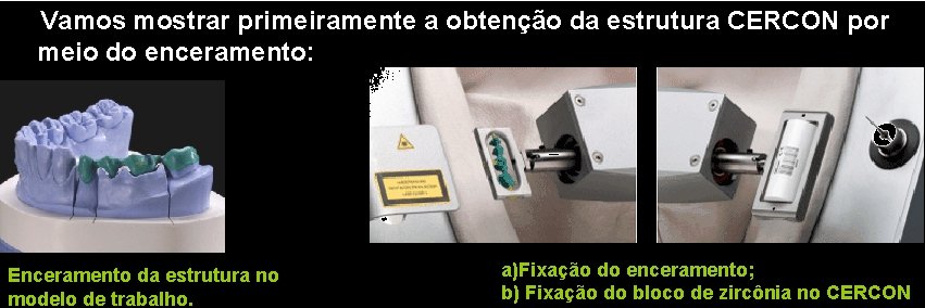 Vamos mostrar primeiramente a obtenção da estrutura CERCON por meio do enceramento: Enceramento da