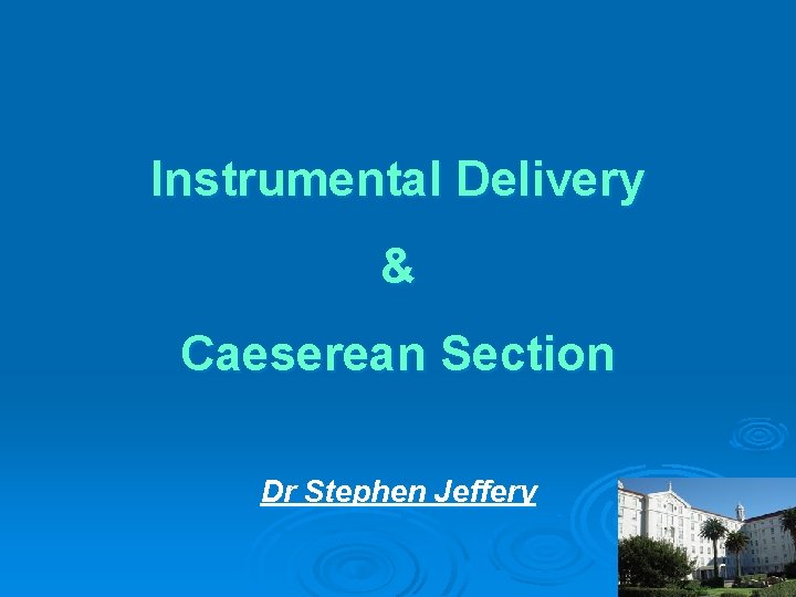 Instrumental Delivery & Caeserean Section Dr Stephen Jeffery 