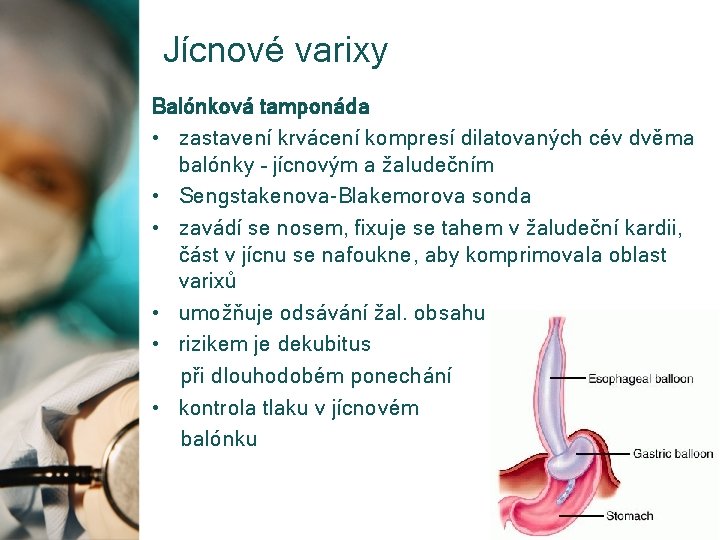 Jícnové varixy Balónková tamponáda • zastavení krvácení kompresí dilatovaných cév dvěma balónky – jícnovým