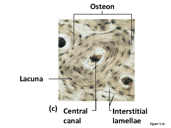 Osteon Lacuna (c) Central canal Interstitial lamellae Figure 5. 4 c 