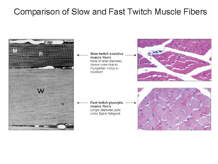 Comparison of Slow and Fast Twitch Muscle Fibers 