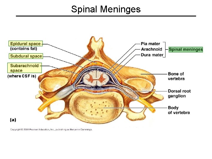 Spinal Meninges (where CSF is) 