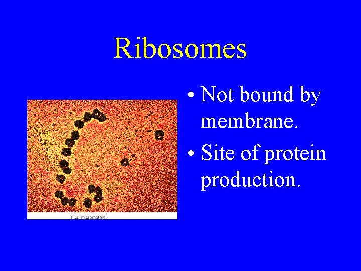 Ribosomes • Not bound by membrane. • Site of protein production. 