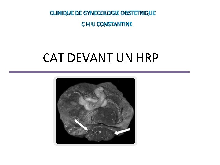 CLINIQUE DE GYNECOLOGIE OBSTETRIQUE C H U CONSTANTINE CAT DEVANT UN HRP 