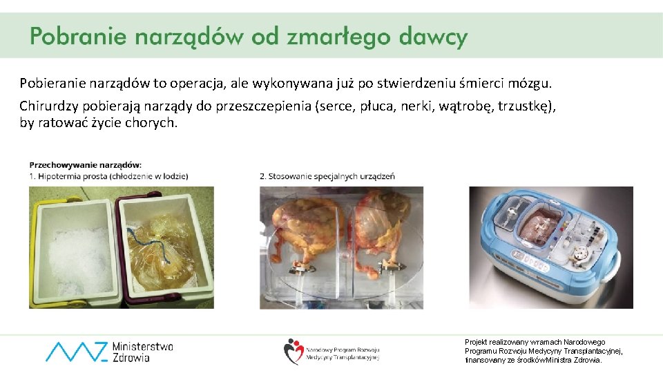 Pobieranie narządów to operacja, ale wykonywana już po stwierdzeniu śmierci mózgu. Chirurdzy pobierają narządy