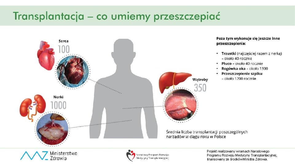 Projekt realizowany w ramach Narodowego Programu Rozwoju Medycyny Transplantacyjnej, finansowany ze środków Ministra Zdrowia.