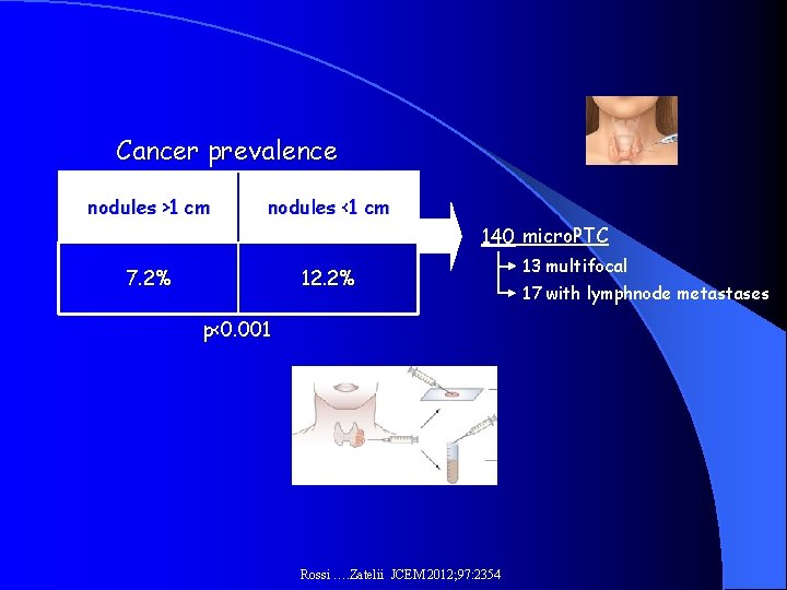 Cancer prevalence nodules >1 cm nodules <1 cm 140 micro. PTC 7. 2% 12.