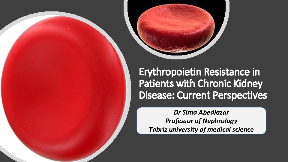 Erythropoietin Resistance in Patients with Chronic Kidney Disease: Current Perspectives Dr Sima Abediazar Professor