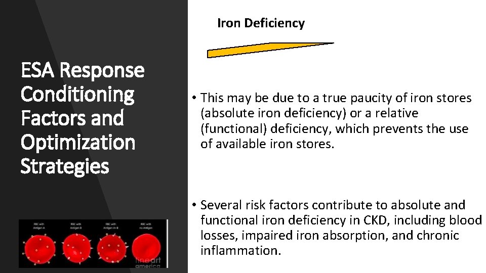 Iron Deficiency ESA Response Conditioning Factors and Optimization Strategies • This may be due