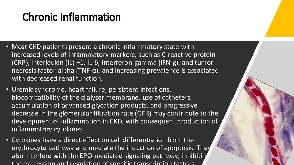 Chronic Inflammation • Most CKD patients present a chronic inflammatory state with increased levels