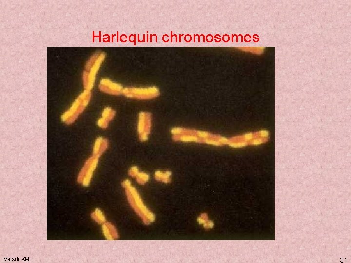 Harlequin chromosomes Meiosis KM 31 