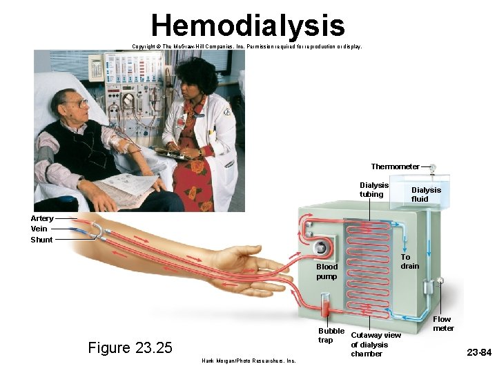 Hemodialysis Copyright © The Mc. Graw-Hill Companies, Inc. Permission required for reproduction or display.