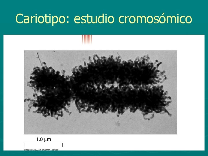 Cariotipo: estudio cromosómico 