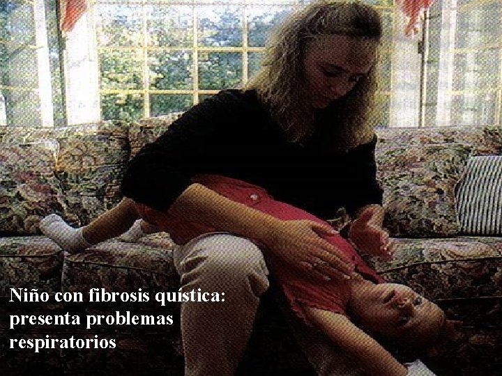 Niño con fibrosis quística: presenta problemas respiratorios 