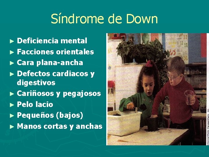 Síndrome de Down ► Deficiencia mental ► Facciones orientales ► Cara plana-ancha ► Defectos