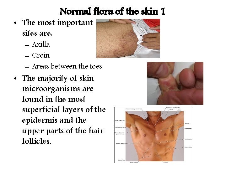 Normal flora of the skin 1 • The most important sites are: – Axilla