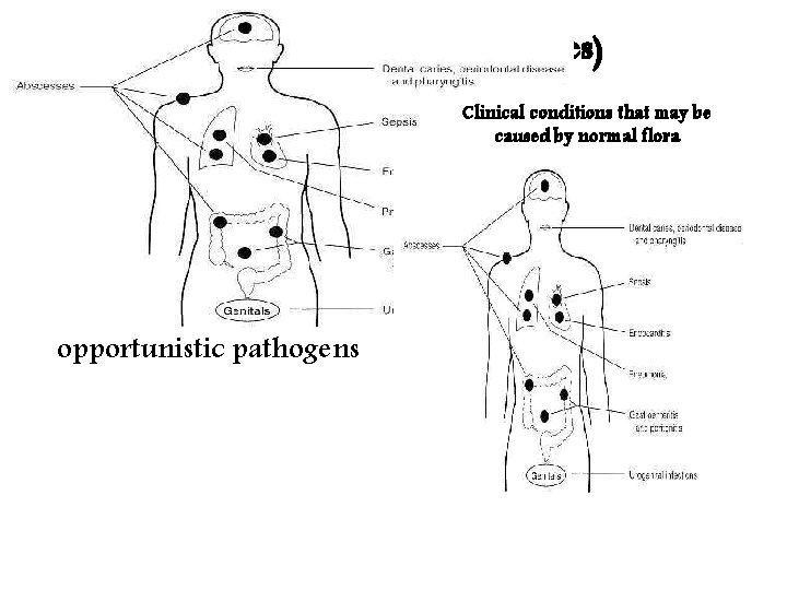 Normal flora (Disadvantages) Cause disease/harm in: - Immunocompromised or debilitated individuals. - When they