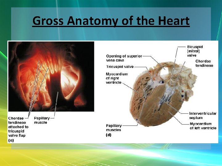 Gross Anatomy of the Heart 