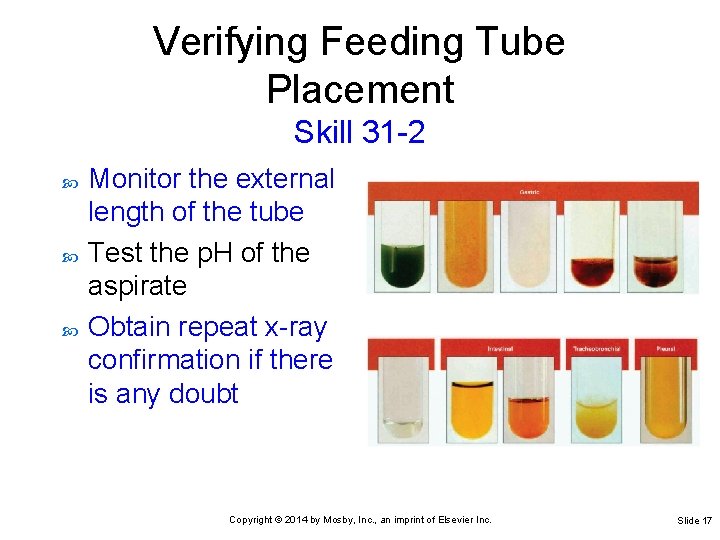 Verifying Feeding Tube Placement Skill 31 -2 Monitor the external length of the tube