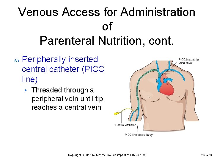 Venous Access for Administration of Parenteral Nutrition, cont. Peripherally inserted central catheter (PICC line)