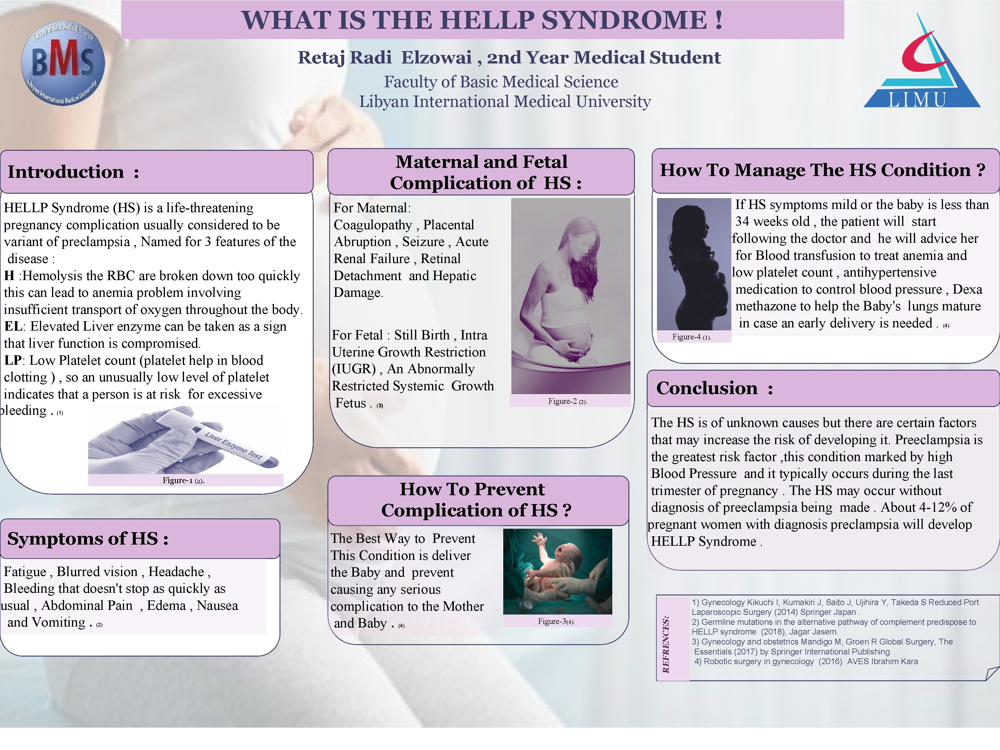 WHAT IS THE HELLP SYNDROME ! Retaj Radi Elzowai , 2 nd Year Medical