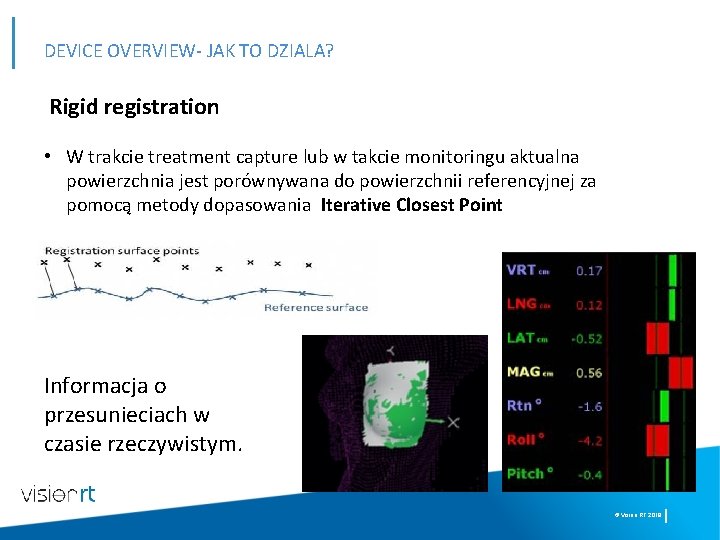 DEVICE OVERVIEW- JAK TO DZIALA? Rigid registration • W trakcie treatment capture lub w