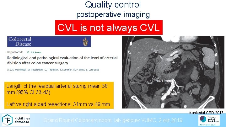 Quality control postoperative imaging CVL is not always CVL Length of the residual arterial