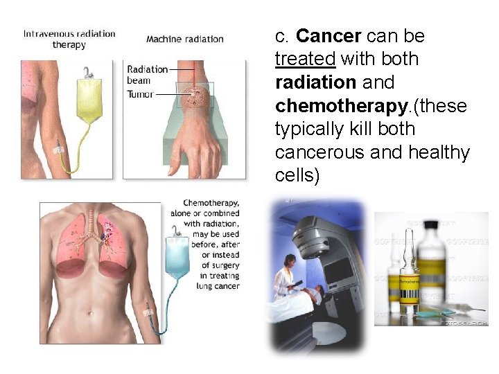c. Cancer can be treated with both radiation and chemotherapy. (these typically kill both c. Cancer can be treated with both radiation and chemotherapy. (these typically kill both