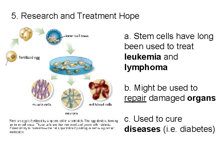 5. Research and Treatment Hope a. Stem cells have long been used to treat 5. Research and Treatment Hope a. Stem cells have long been used to treat