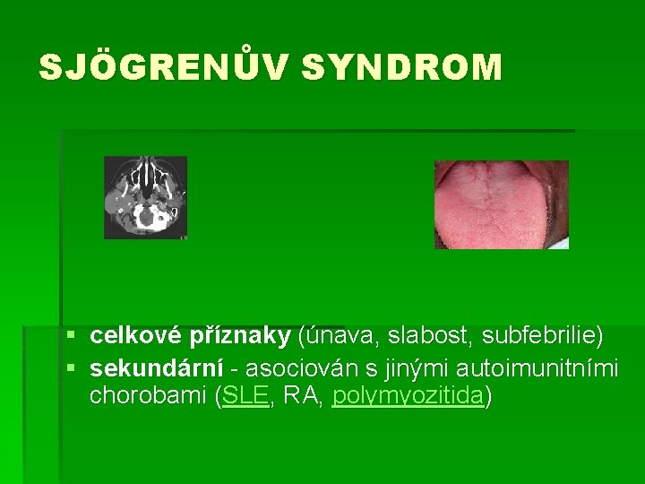 SJÖGRENŮV SYNDROM § celkové příznaky (únava, slabost, subfebrilie) § sekundární - asociován s jinými