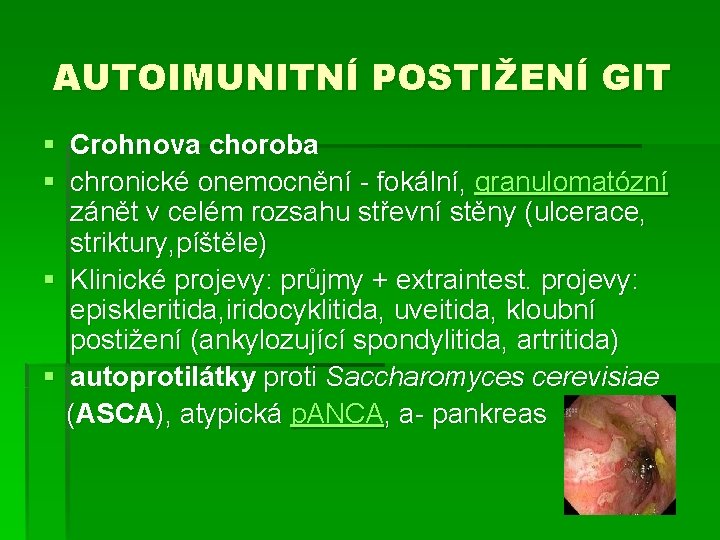 AUTOIMUNITNÍ POSTIŽENÍ GIT § Crohnova choroba § chronické onemocnění - fokální, granulomatózní zánět v