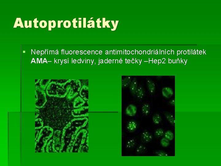 Autoprotilátky § Nepřímá fluorescence antimitochondriálních protilátek AMA– krysí ledviny, jaderné tečky –Hep 2 buňky