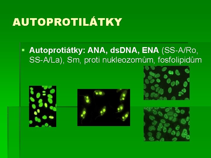 AUTOPROTILÁTKY § Autoprotiátky: ANA, ds. DNA, ENA (SS-A/Ro, SS-A/La), Sm, proti nukleozomům, fosfolipidům 