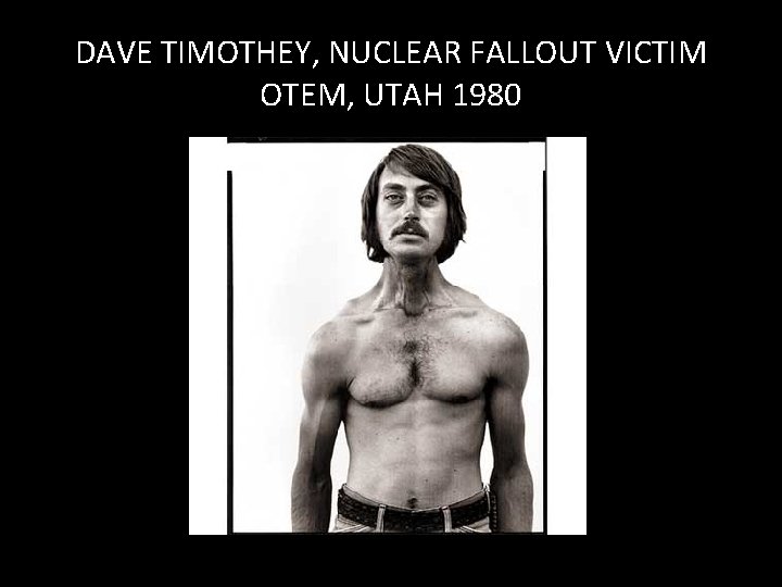 DAVE TIMOTHEY, NUCLEAR FALLOUT VICTIM OTEM, UTAH 1980 