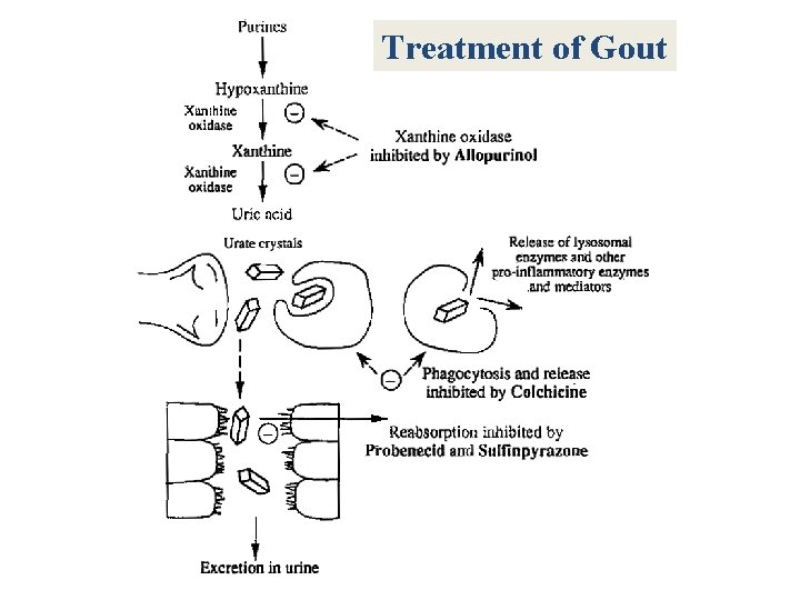Treatment of Gout 