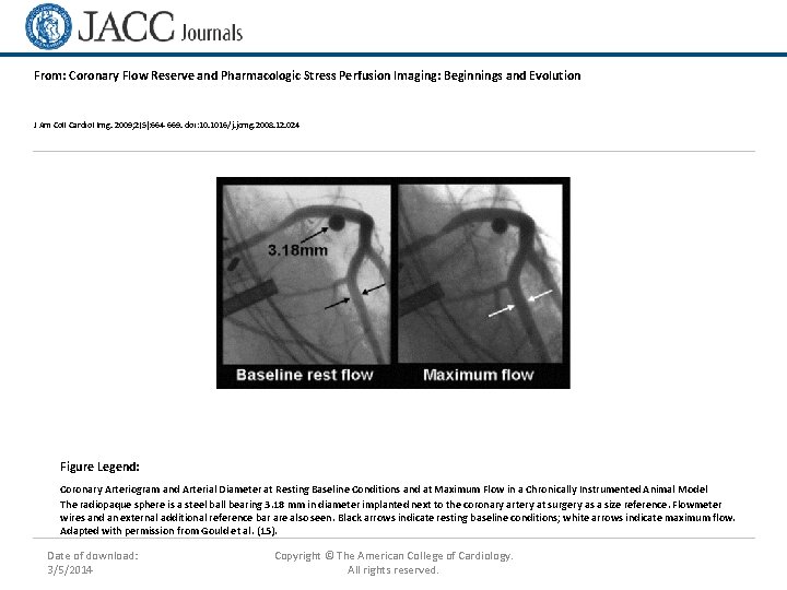 From: Coronary Flow Reserve and Pharmacologic Stress Perfusion Imaging: Beginnings and Evolution J Am