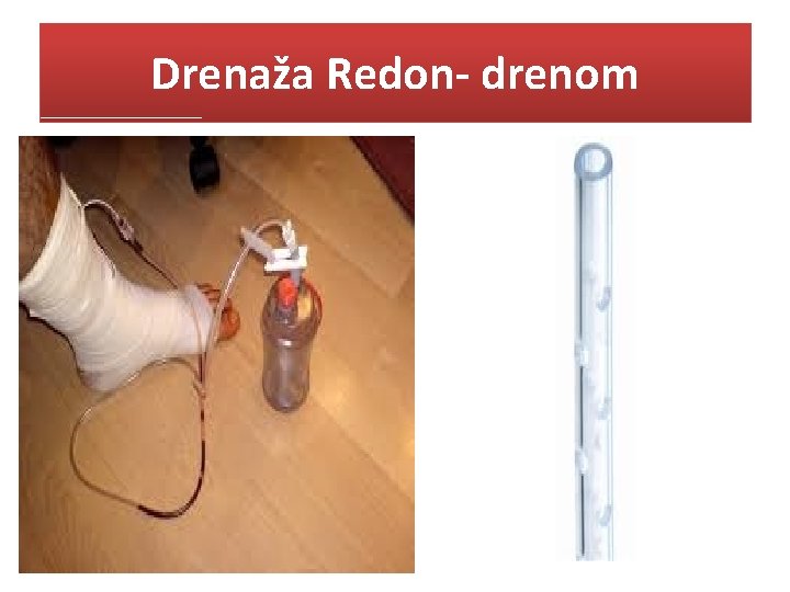 Drenaža Redon- drenom 